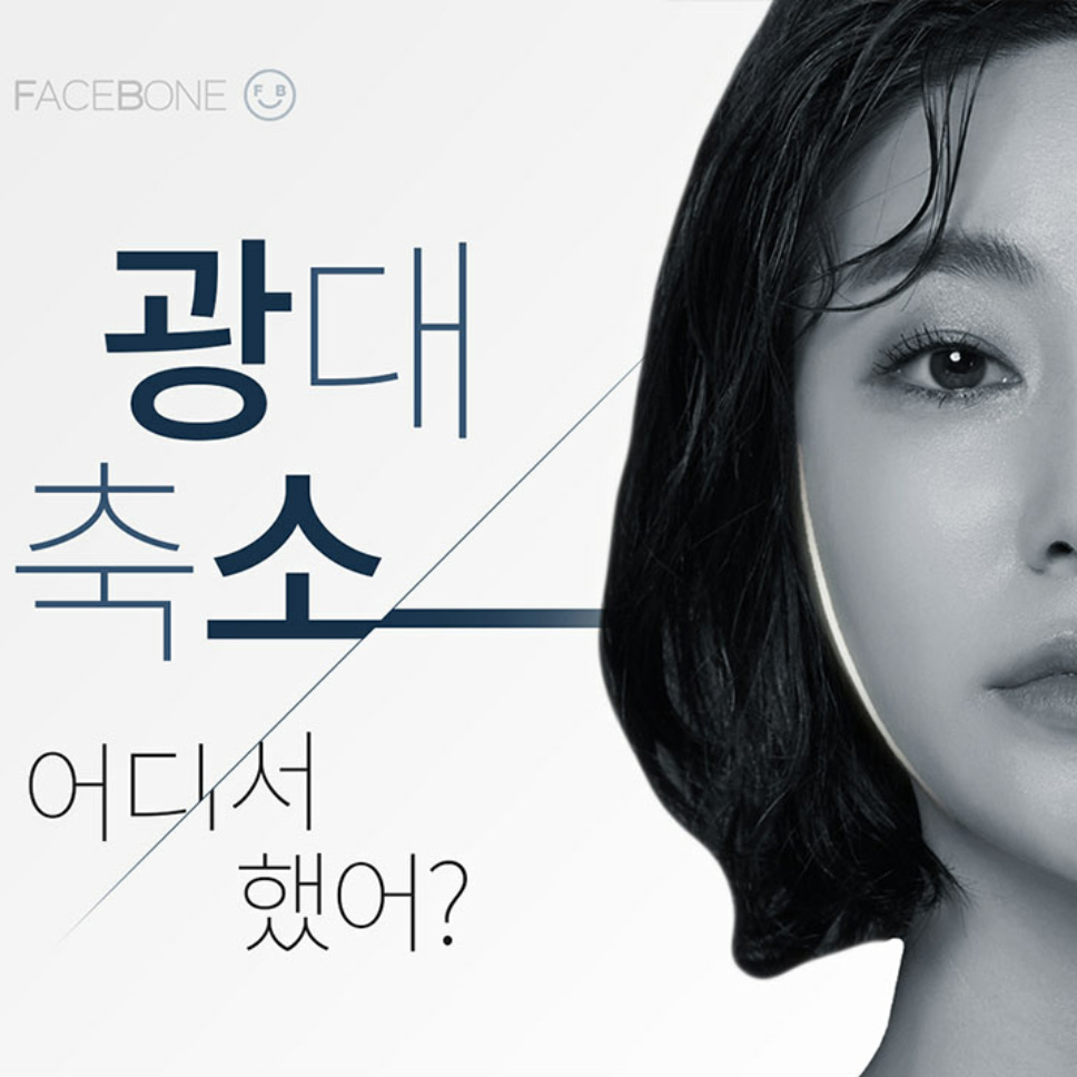 광대축소 어디서했어?