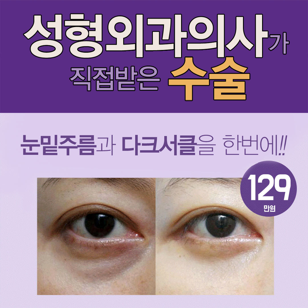 눈밑지방재배치 당김술